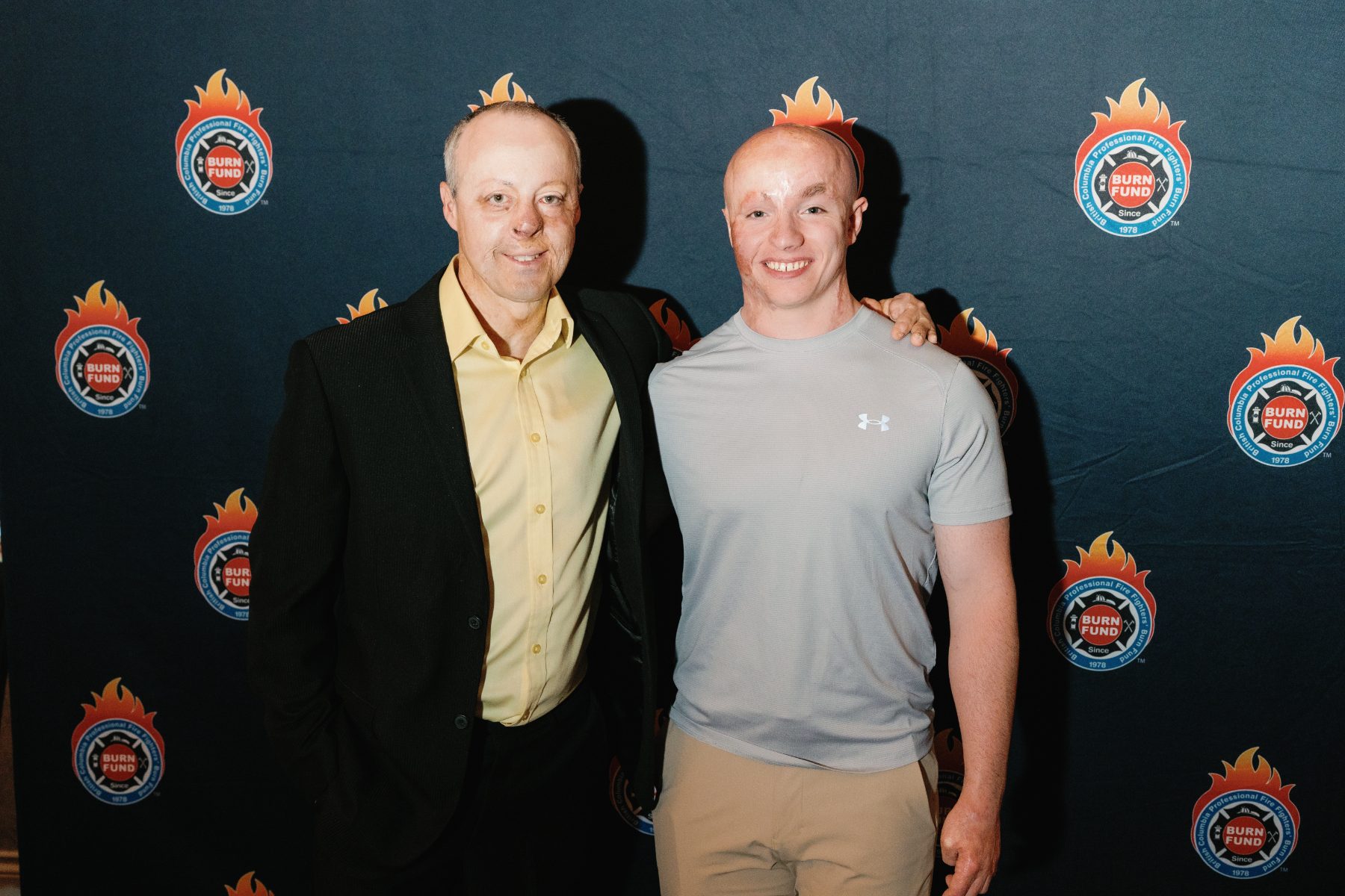 Two burn survivors at the 2025 Burn Fund gala