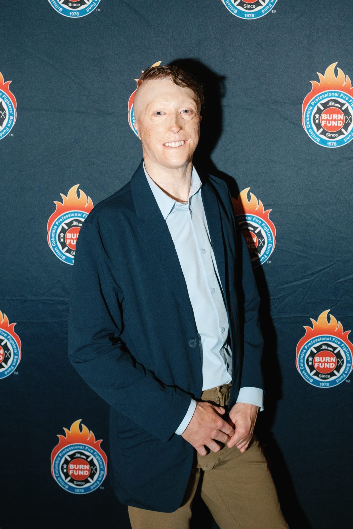 A burn survivor at the Burn Fund gala during the 2025 Forum